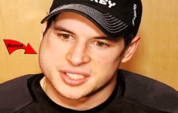 NHL Sidney Crosby mumps