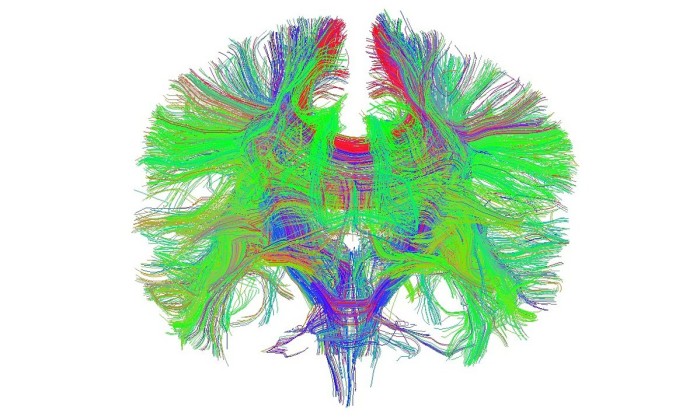 brain scan weed